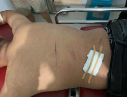 Pemuda Asik Pesta Miras di Polewali Diserang OTK dengan Sajam, Tiga Handphone Raib