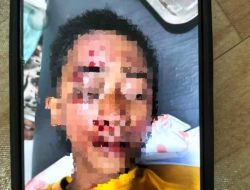 Tertabrak Saat Berjalan Kaki, Seorang Ibu Luka-Luka — Polisi Bergerak Cepat Amankan Lokasi dan Korban